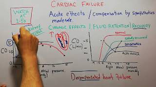 CVS 216  Decompensated heart failure  Compensated heart failure [upl. by Manya]