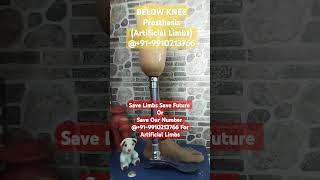 Best Below Knee Prosthesis Services 919910213766 Amputee Prosthesis Delhi [upl. by Penelopa]