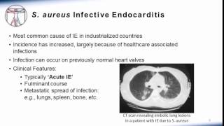 Endocarditis Microbiology and Treatment [upl. by Dixil508]