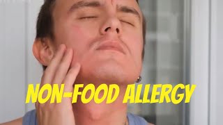 NonFood Allergy [upl. by Eelsel791]