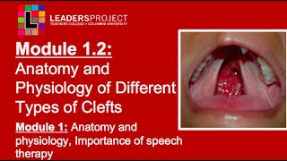 Module 12 Cleft Palate Speech and Feeding Anatomy and Physiology of Cleft Lip and Palate [upl. by Hoxsie]