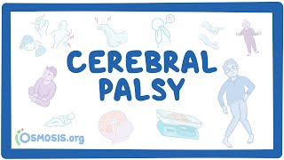 Cerebral palsy CP  causes symptoms diagnosis treatment pathology [upl. by Luther758]