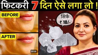 10 रूपए की चीज़ से Skin की सारी मुश्किल आसान  Facial Hair झाइयाँ Hyperpigmentation Wrinkles amp More💕 [upl. by Narbig]