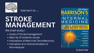 Stroke management [upl. by Hedveh]