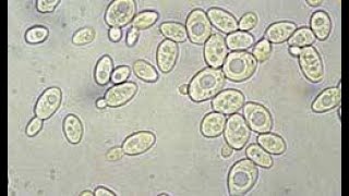 Activité B21 observation microscopique des levures de boulanger [upl. by Max15]