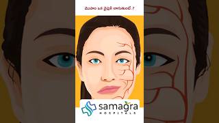 Understanding Hemifacial Spasm HemifacialSpasm DrKNeeraja Neurologist SamagraHospitals Guntur [upl. by Berfield898]