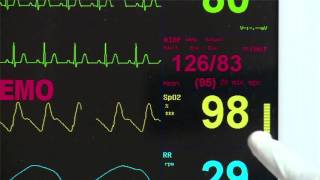 BPL Ultima Prime Series Patient Monitors [upl. by Lindeberg]