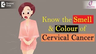 Smell and Colour of Cervical Cancer  Check for these Important Signs   Dr Sapna Lulla of C9 [upl. by Berna]