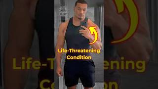 Larry Wheels Hospitalized Rhabdomyolysis Explained Max Out shorts fitness gym maxstrength [upl. by Taka]