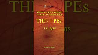 Choroidal Folds THIN RPEs Mnemonic rule to remember 8 causes [upl. by Aetnuahs]