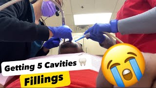 Escape Dental Nightmares My Experience with 5 Cavities Fillings 😱 dentist toothcare [upl. by Ragas]