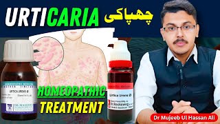 Urtica Urens Homeopathic Medicine Uses  Urticaria  Homeopathic Treatment [upl. by Alyehc989]