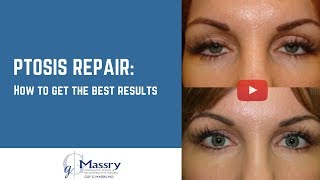 Ptosis Repair  How To Get The Best Ptosis Repair Results [upl. by Fredella]