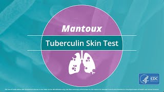 Mantoux Tuberculin Skin Test Video [upl. by Amero]