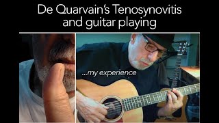 De Quarvains Tenosynovitis and Guitar Playing My Experience [upl. by Lrigybab]