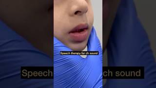 Speech Therapy  Articulation ch Sound  Tongue Positioning  Mis articulation  Teach Sound [upl. by Kcirdde270]