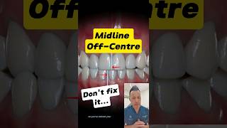 Why Your OffCenter Midline Is No Big Deal dentallan dentist shorts [upl. by Ahsyat940]