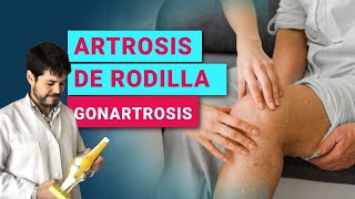 ¿QUÉ ES LA ARTROSIS DE RODILLA GONARTROSIS  PROLOTERAPIA  PRP  CÉLULAS MADRE [upl. by Baron403]