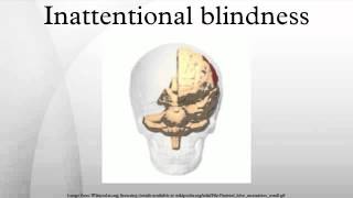 Inattentional blindness [upl. by Prober]