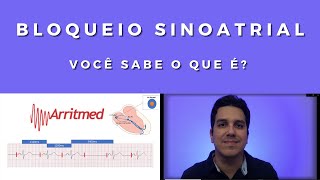 Bloqueio Sinoatrial  Você sabe o que é [upl. by Drofiar]