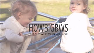 BeckwithWiedemann Syndrome  What is BWS [upl. by Amleht]