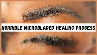 Watch this before you consider microblading your eyebrows  Microblading eyebrows healing process [upl. by Elimac]