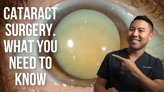 CATARACT SURGERY Everything you need to know MichaelRChuaMD [upl. by Oiruam]