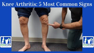 Knee Arthritis 5 Most Common Signs You Have It [upl. by Rhyne895]