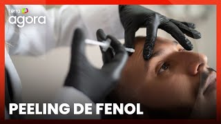 Peeling de fenol como funciona e quais os riscos do procedimento [upl. by Maggs159]