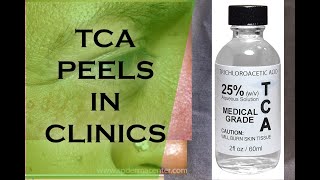 TCA PEELS IN CLINICS for Syringoma Removal [upl. by Gillett]