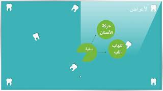 Temporomandibular Joint Disorder اضطربات المفصل الفكي الصدغي [upl. by Chappy]