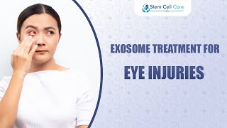 Exosome Treatment For Eye Injuries  Stem Cell Therapy  Vision Loss  Eye Problems [upl. by Roybn]