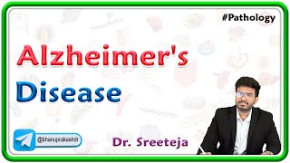 7 Alzheimers Disease Pathology  USMLE Step 1 [upl. by Morette]