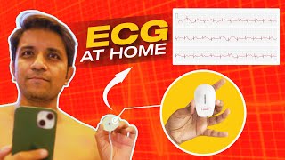 ECG ❤️ at Home 2Minutes Test  Spandan ECG Unboxing amp Demo  Featured on Shark Tank ⚡ [upl. by Volpe]