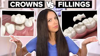 Dental Crowns Vs Dental Fillings Whats the Difference [upl. by Sasnett674]