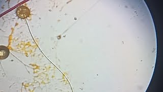 Pollen Germination On Slide Using Nutrient Solution [upl. by Henn781]