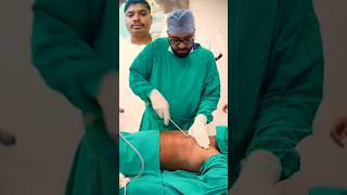 Gynaecomastia Surgery youtubeshorts trending youtubevideos short [upl. by Etnahs32]