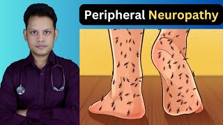 Top 3 Signs of Peripheral Neuropathy [upl. by Ramo]