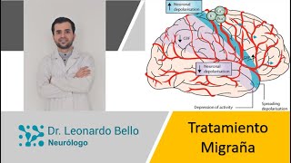 Lo que no te han enseñado del tratamiento para la migraña [upl. by Nitsirhc]