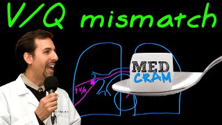 Ventilation Perfusion VQ Mismatch Explained Clearly [upl. by Cuttler666]