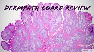 Dermatopathology Board Review for Dermatology Pathology Dermpath 19 Classic Cases [upl. by Aisorbma922]