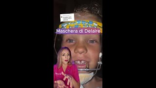 🦷 Cosè la Maschera di Delaire 🎥 [upl. by Gula]