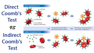 DCT amp ICT pathology pathologylab hematology hemepath immunology [upl. by Hakilam974]