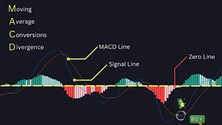 What is Macd Real Vide💯💯indicators In Live Market how to use macd indicator macd sikhe Hindi me [upl. by Nelan79]