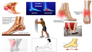 Correct Plantar Fasciitis Quickly Medically Proven The Best Exercises amp Stretches  Dr Mandell [upl. by Ihcekn]