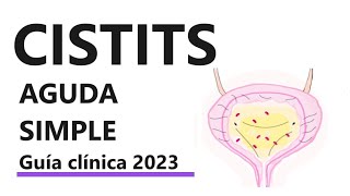 Cistitis aguda simple  Guía 2023 diagnóstico y tratamiento ITU no complicada [upl. by Aneen]