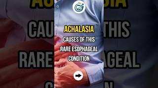 ACHALASIA CAUSES OF THIS RARE ESOPHAGEAL CONDITION shorts achalasia esophagus doctor [upl. by Marcelia]