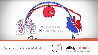 Uitleganimatie  VUmc Pulmonale Hypertensie [upl. by Candis]