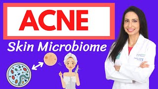 ACNE and the Skin Microbiome A Holistic Approach to Healing Your Acne from the Inside Out [upl. by Trici815]