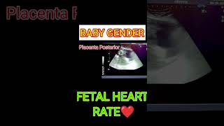 FETAL HEART RATE VS BABY GENDER shortsfeed shorts [upl. by Shel]